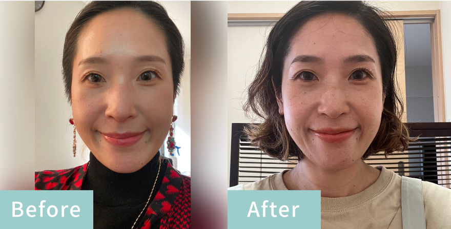 before&After画像